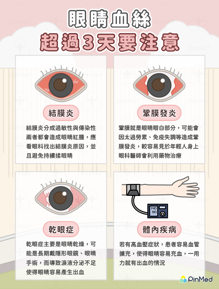 眼睛血絲_眼睛血絲原因