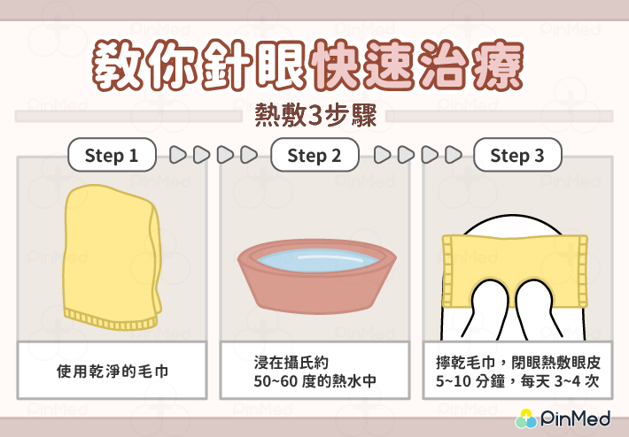 針眼快速治療-圖2