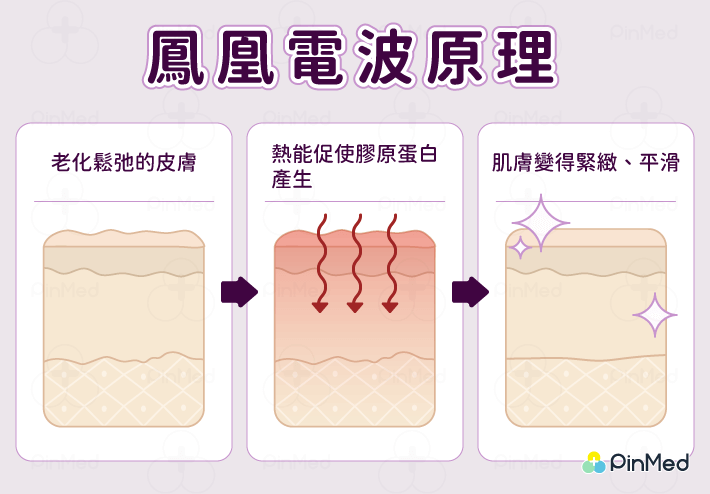 鳳凰電波_鳳凰電波原理