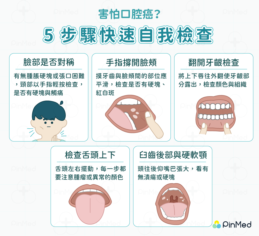 口腔癌