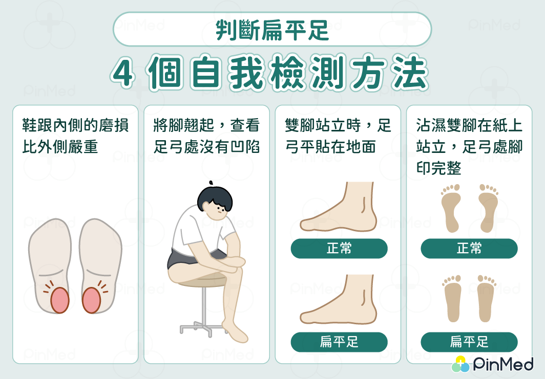 扁平足判斷_自我檢測