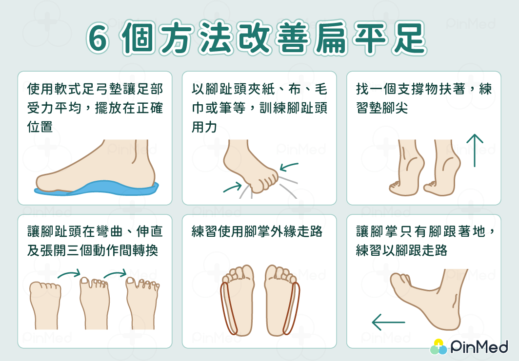 扁平足判斷_改善扁平足