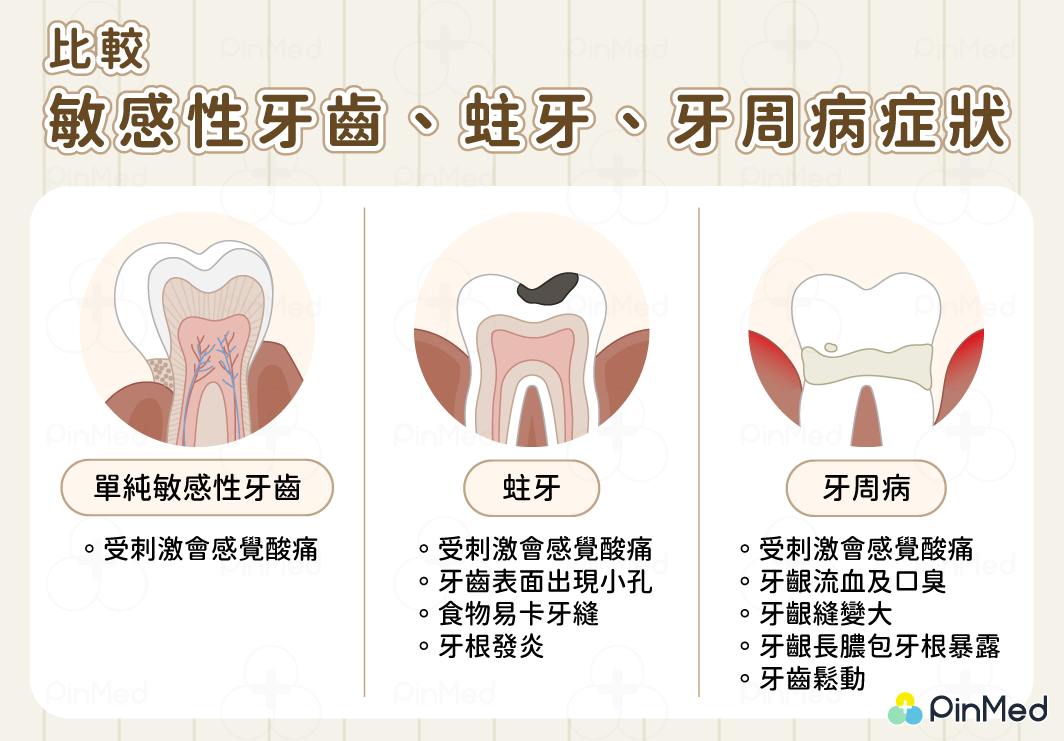 牙齒痠痛_比較敏感性牙齒、蛀牙、牙周症狀