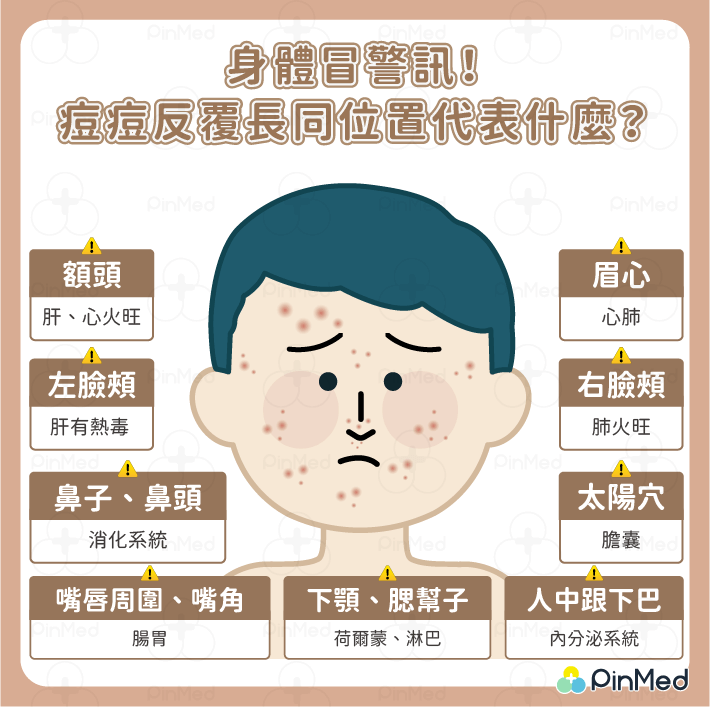 痘痘位置