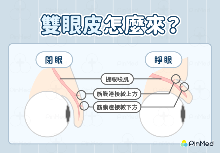 雙眼皮怎麼來