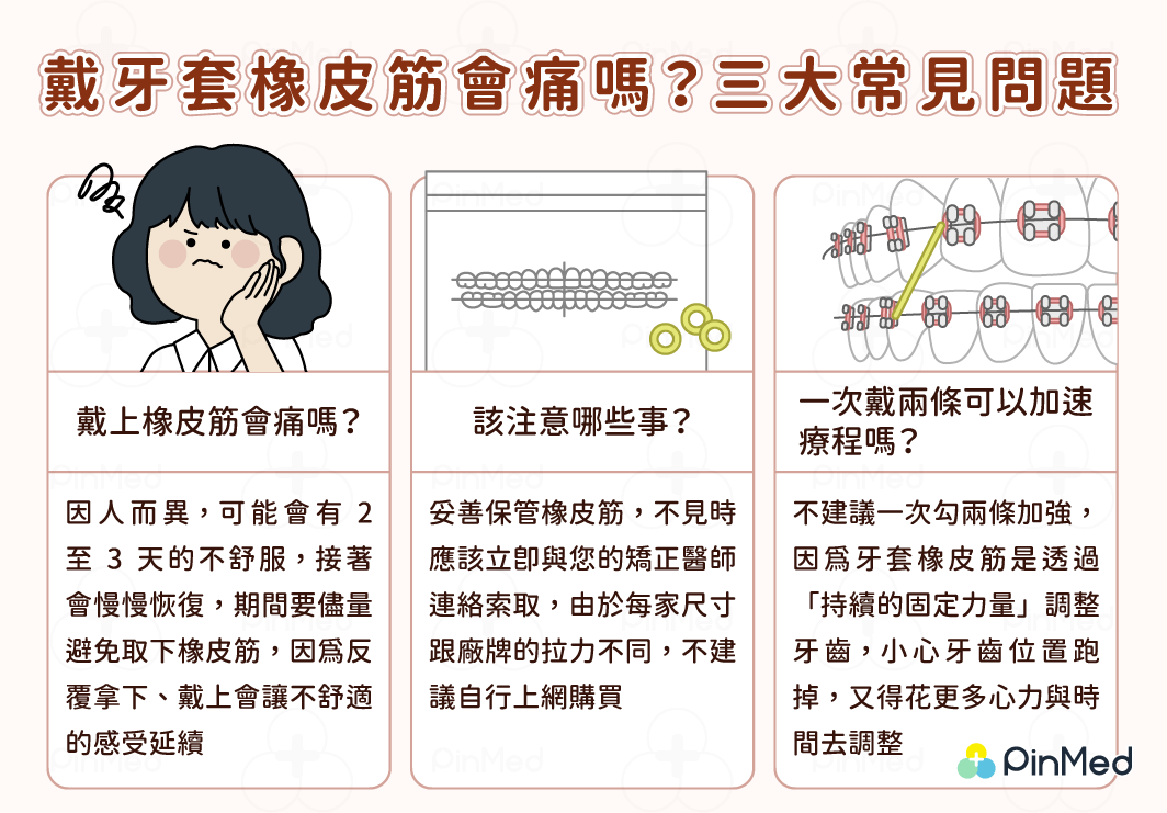 牙套橡皮筋