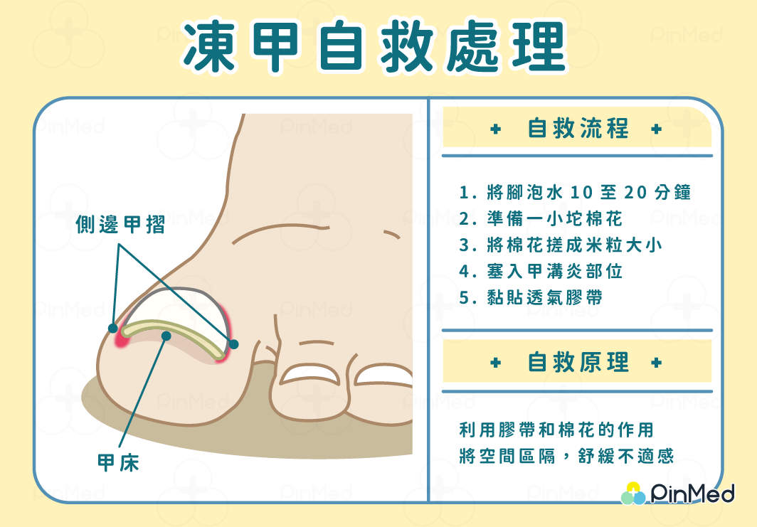 凍甲自救