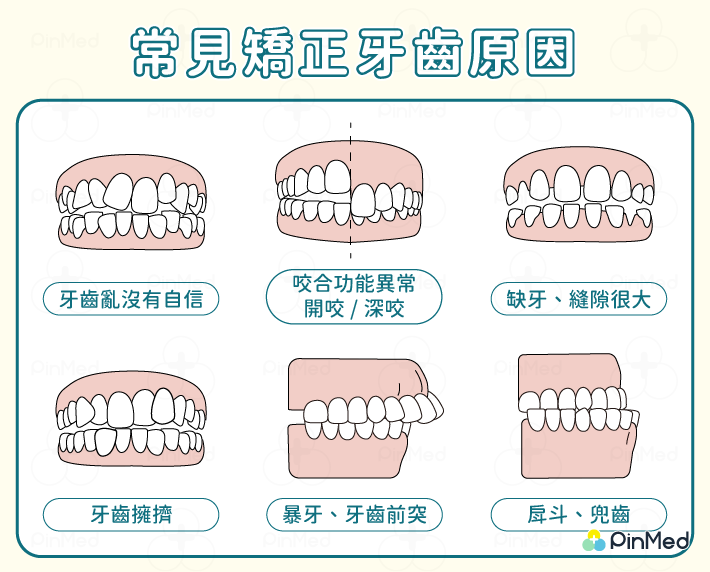 牙齒矯正