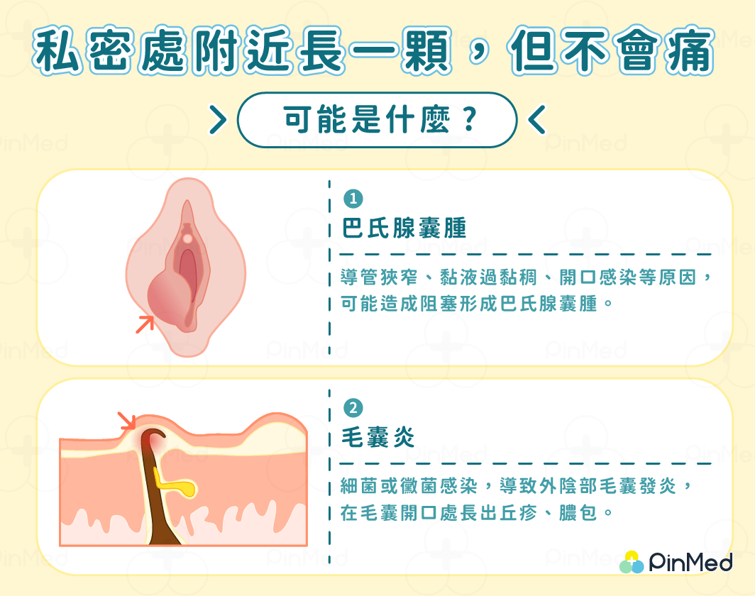 私密處附近長一顆不會痛_可能是什麼