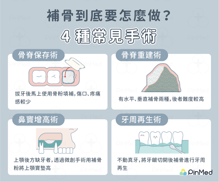 補骨、補牙齦肉是植牙必做嗎？一篇弄懂關鍵因素、過程、要等多久