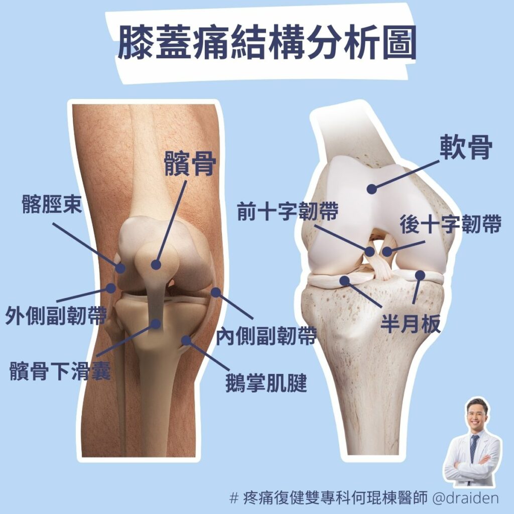 膝蓋痛結構位置分析圖