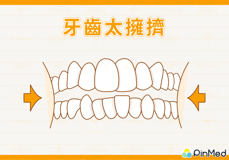 矯正拔牙