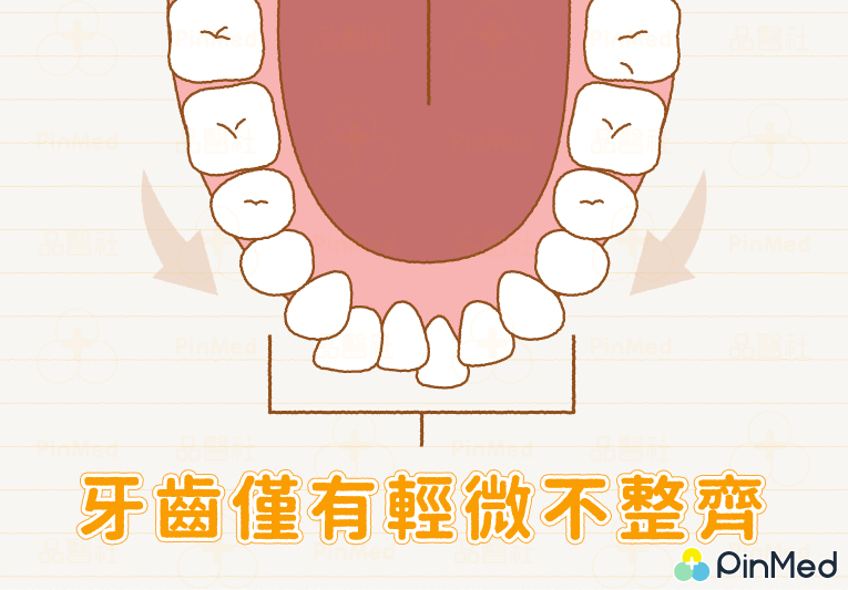 矯正拔牙