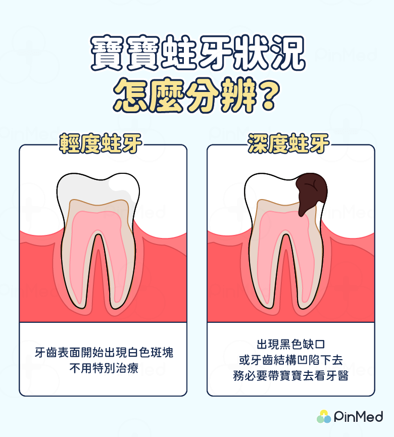 夜奶蛀牙