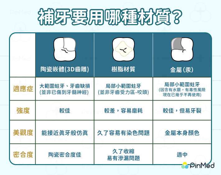 專欄／陶瓷嵌體、全瓷冠差在哪？蛀牙、根管治療必看「瓷」典