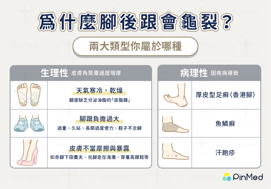 為什麼腳後跟會龜裂？兩大原因你屬於哪種