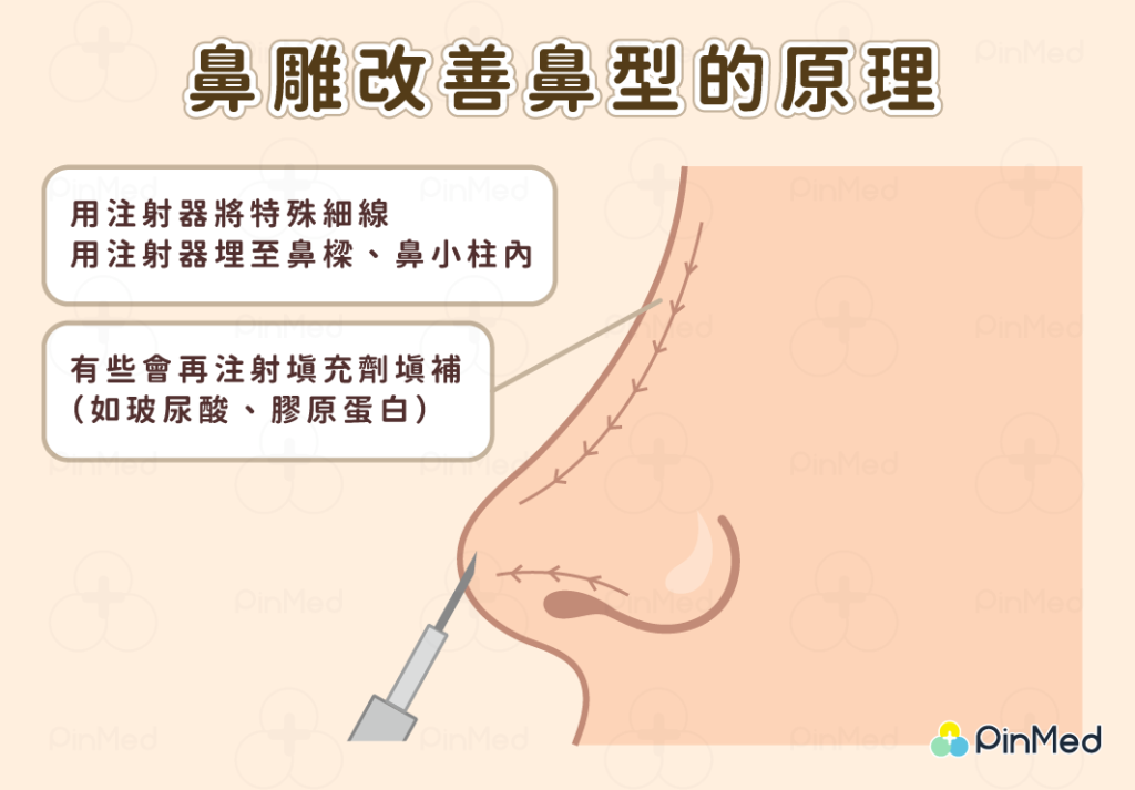 「鼻雕」到底是什麼？ 教你不動手術、快速擁有高挺美鼻！