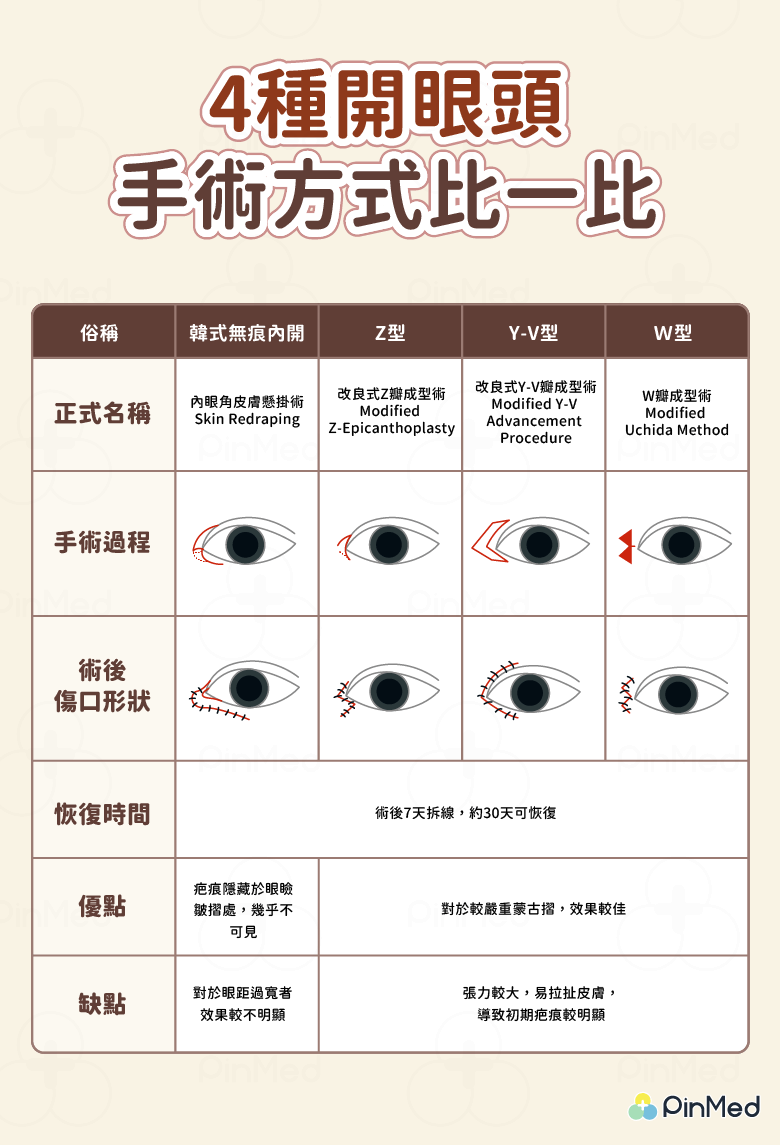 眼睛無神、眼距寬？「開眼頭」能還原明亮大眼嗎？後悔、後遺症疑問精華