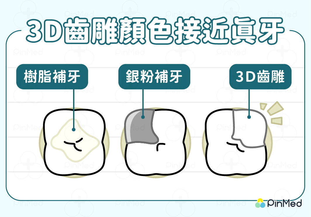 3D齒雕