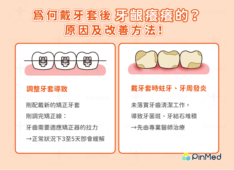 戴牙套牙齦癢原因＆改善方法