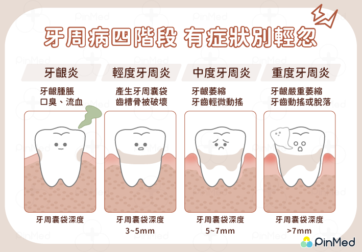 牙周病四階段