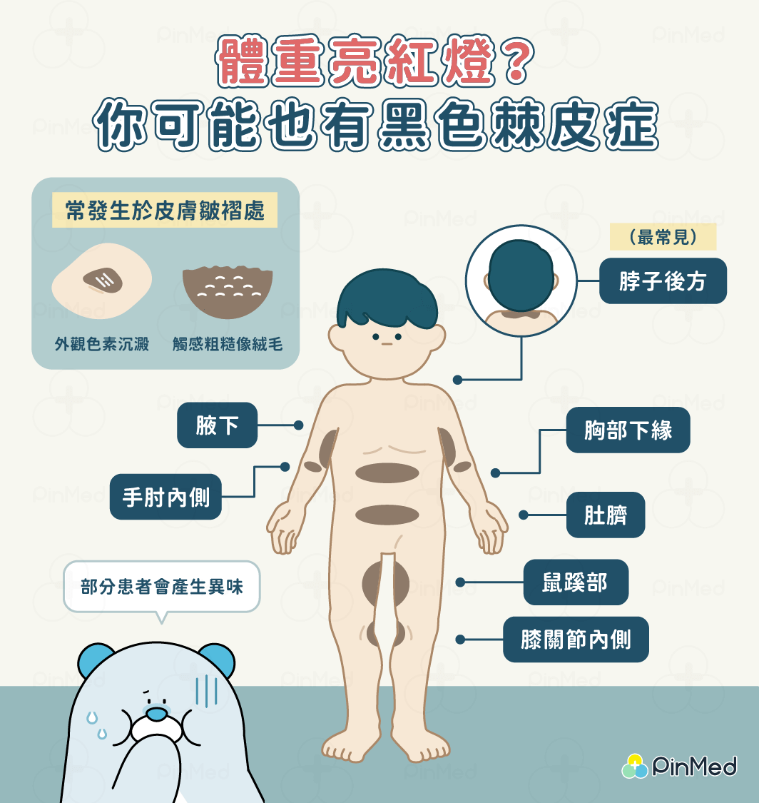 黑色棘皮症症狀