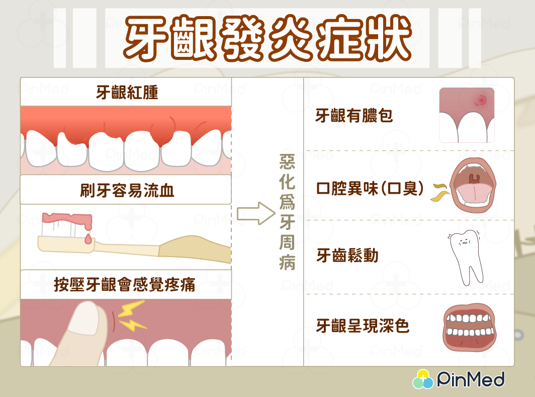 牙齦炎_症狀