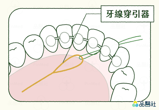 維持器