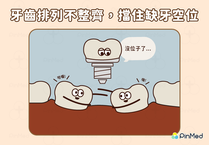 植牙矯正_齒列不整齊、缺牙無空位