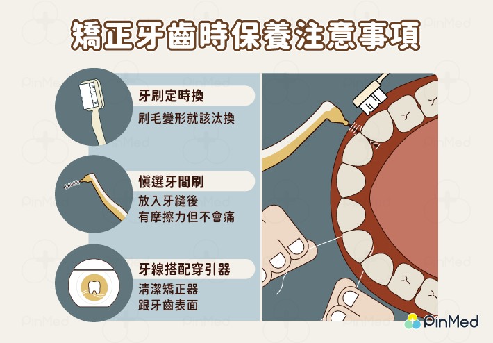 植牙矯正_清潔