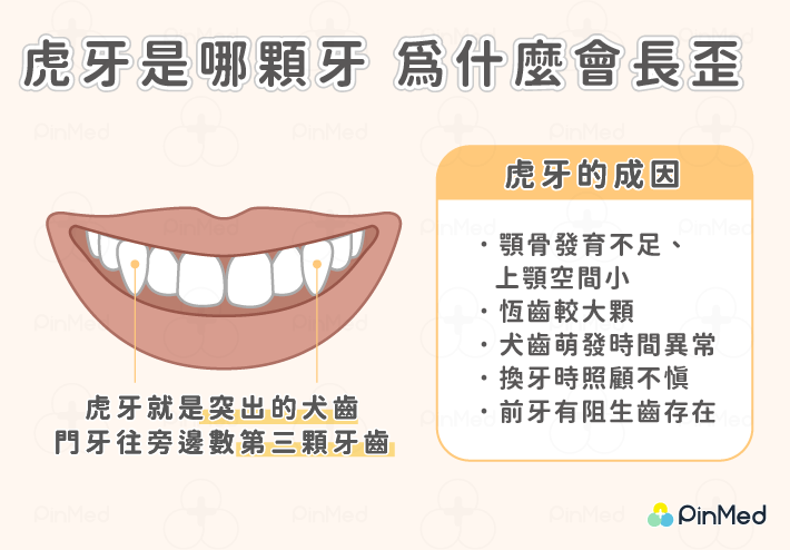 虎牙的成因