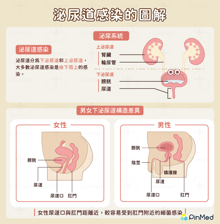 此圖為泌尿道感染的圖解，上半部為泌尿系統的示意圖，下半部說明男女下泌尿道構造的差異，女性的尿道口與肛門較近，因此較容易受到肛門附近的細菌感染