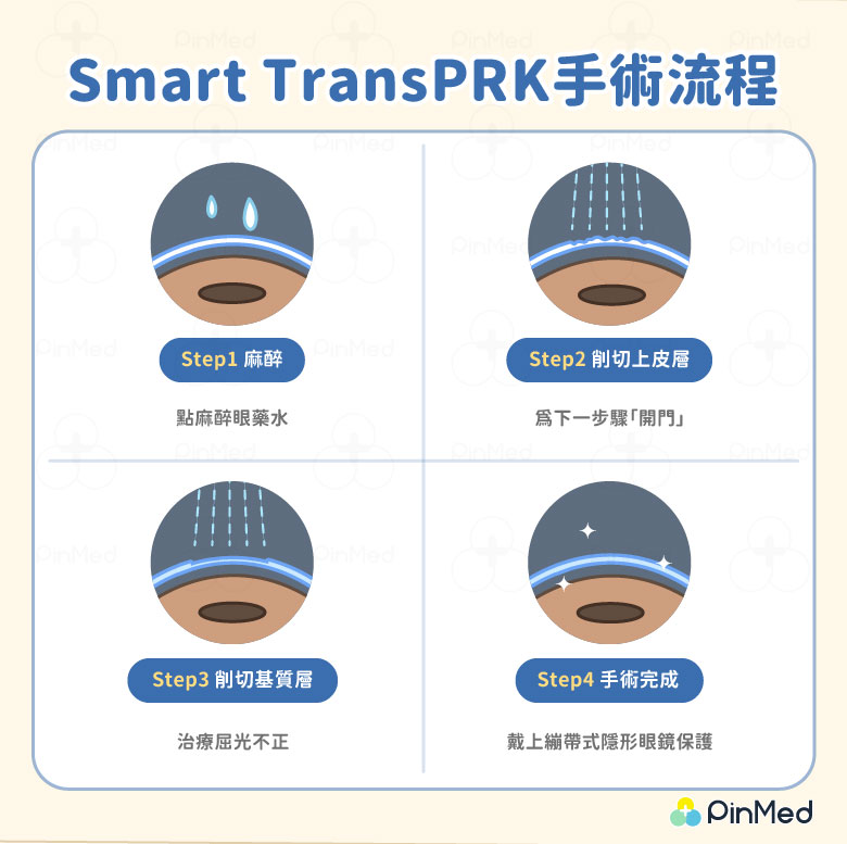 Smart TransPRK手術流程