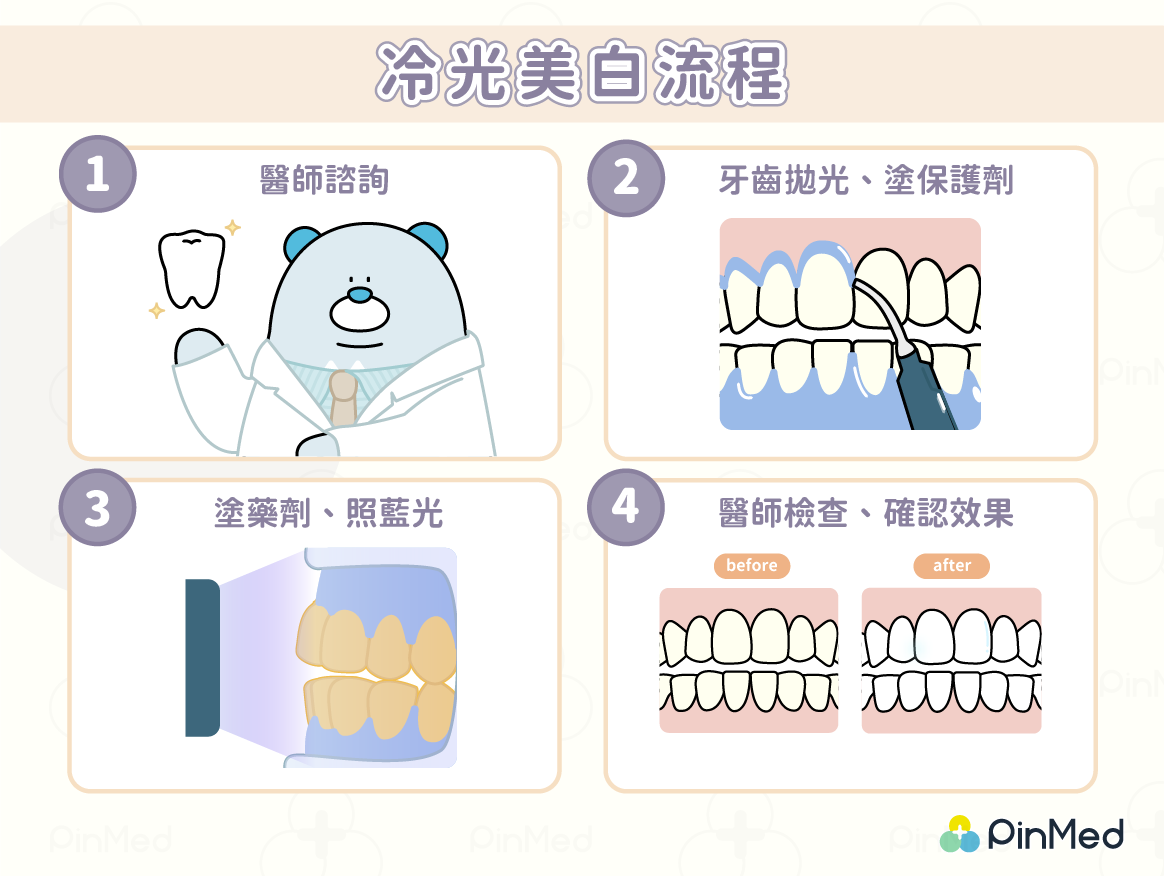 冷光美白流程