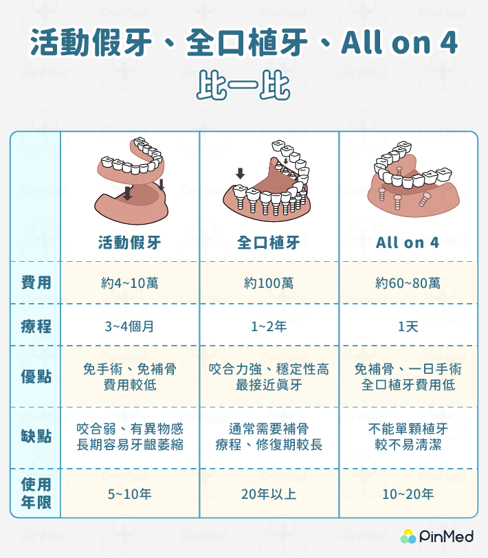 活動假牙、全口植牙、All on 4 比較