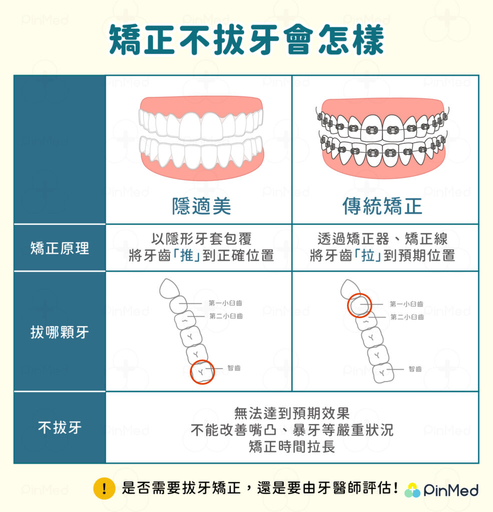 拔牙矯正