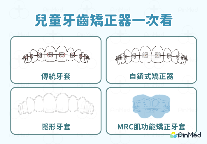 兒童牙齒矯正器一次看