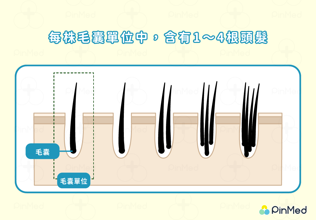 每株毛囊單位中，含有1～4根頭髮。