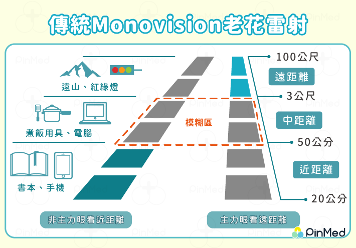 傳統Monovision老花雷射：由於老花最終會成長至300度，只保留 75～100 度的近視不足以抗衡老花的問題。