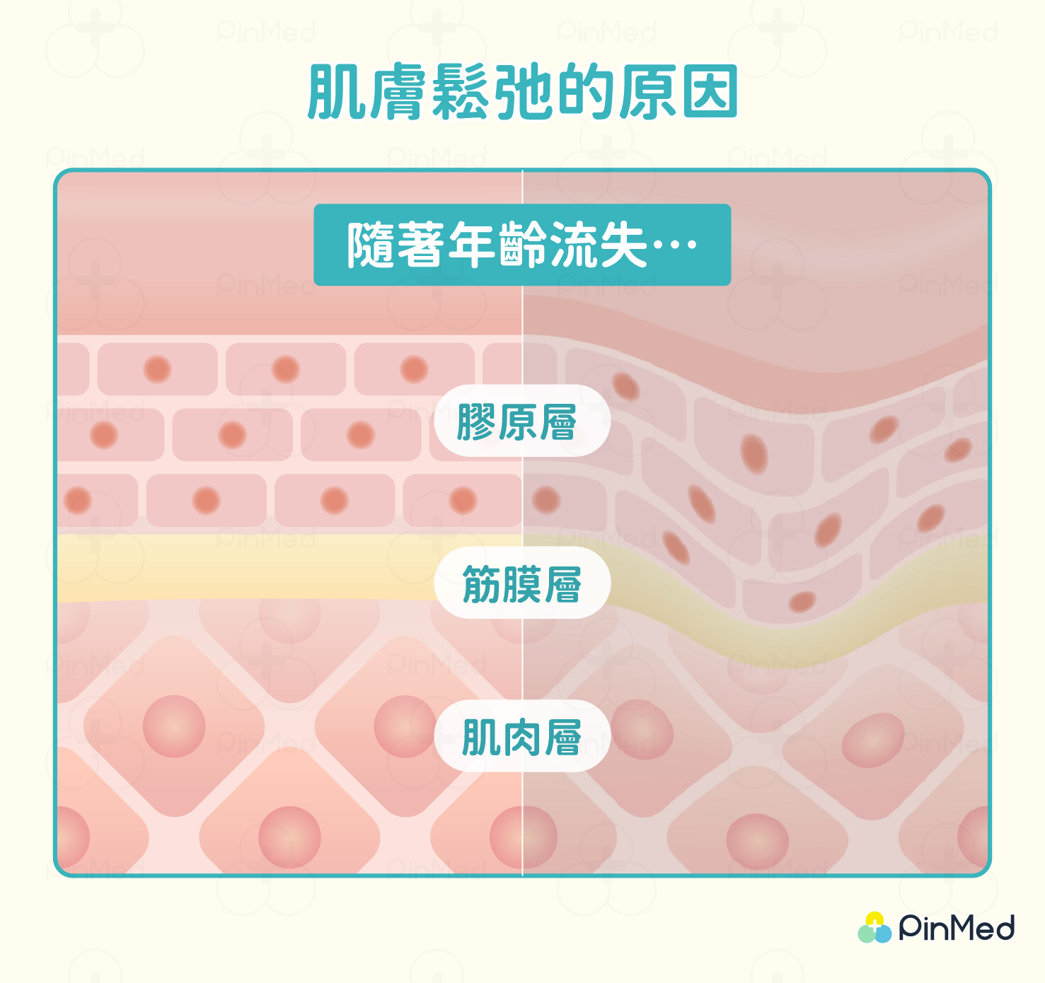 肌膚出現皺紋的原因