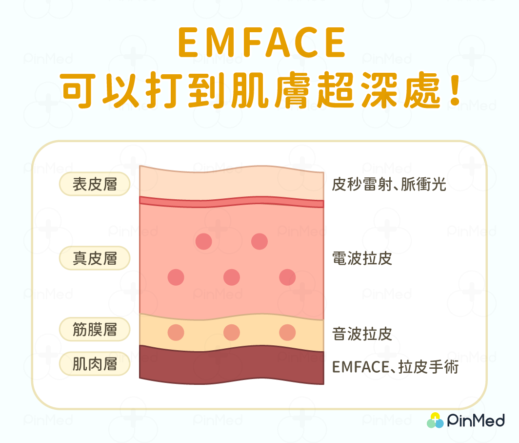 EMFACE台灣哪裡打？3分鐘掌握認證診所，讓你悄悄變年輕！