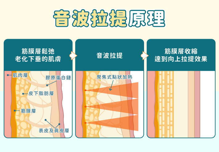 音波拉提原理