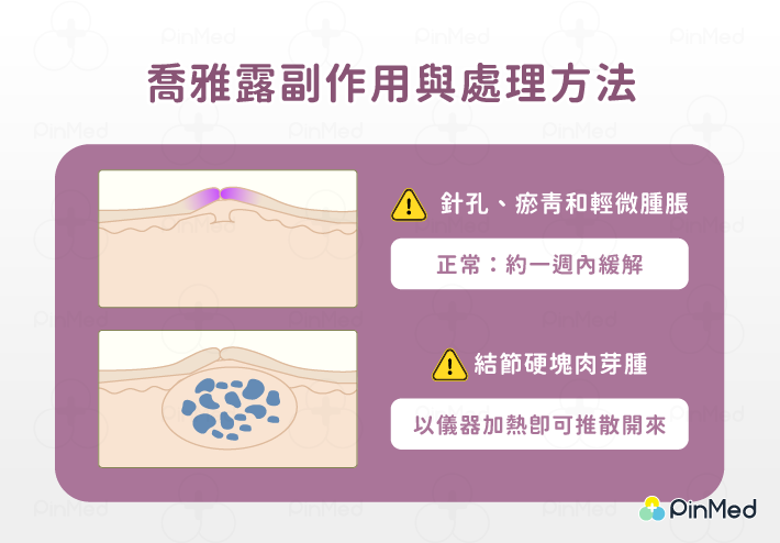 喬雅露副作用處理方法