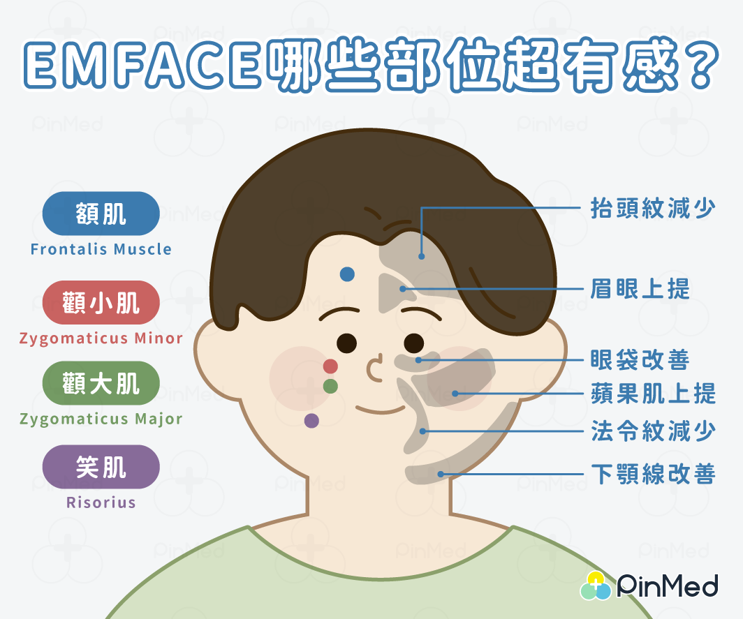 EMFACE適合部位與效果