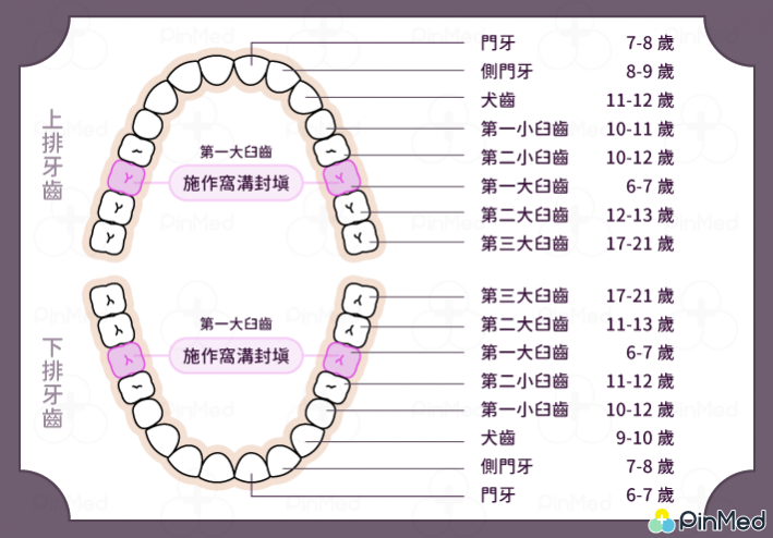 窩溝封填_圖1 (1) 窩溝封填_圖1 (1)