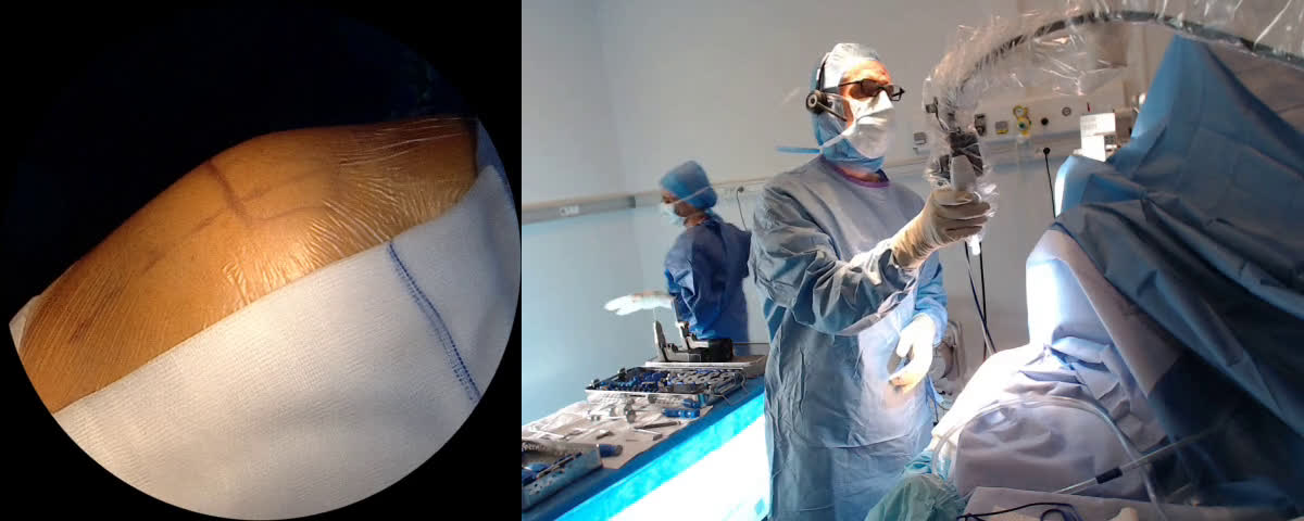 INVIVOX Shoulder surgery and arthroscopy with Dr