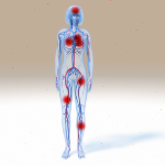Hormones & thromboses
