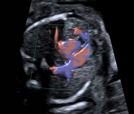 Invivox Formation Theorique Et Pratique En Echographie Obstetricale Doppler Et Autres Techniques