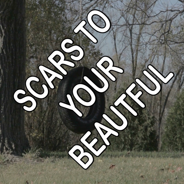 Scars To Your Beautiful - Tribute to Alessia Cara