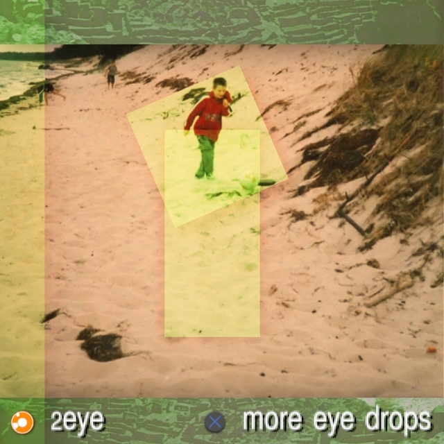 More Eye Drops Ep